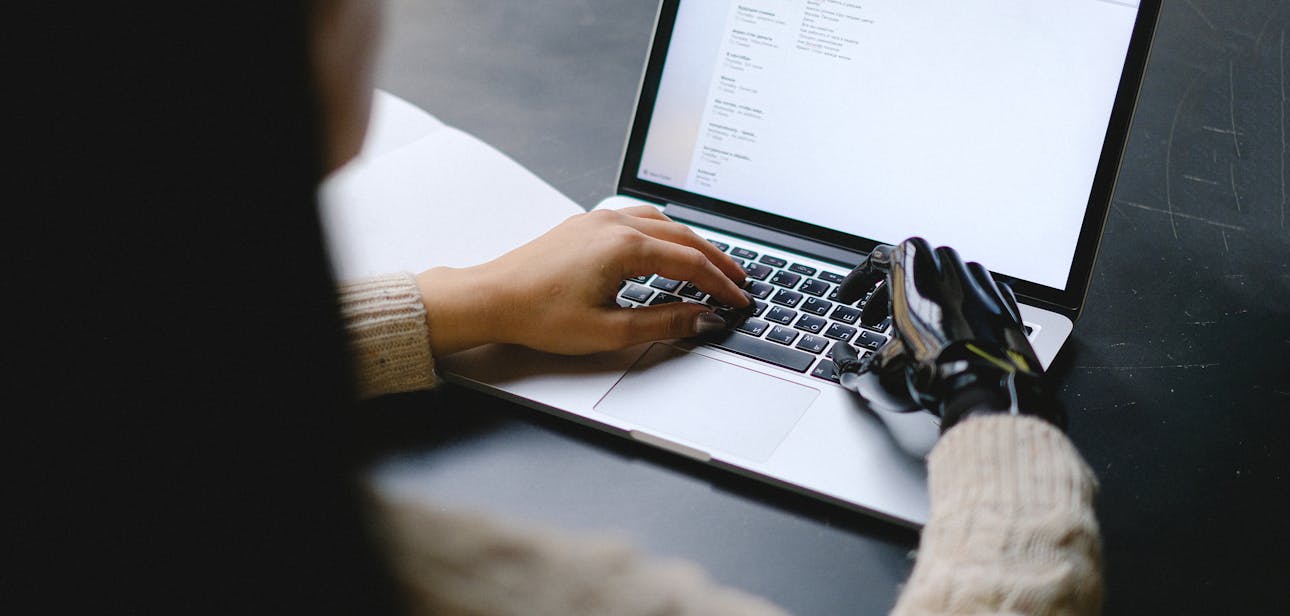 A person with a prosthetic hand using a laptop, showcasing technology and inclusivity.