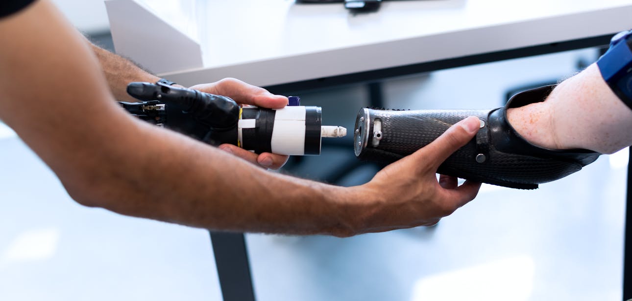 Person helping another attach a prosthetic arm, showcasing technology and support.