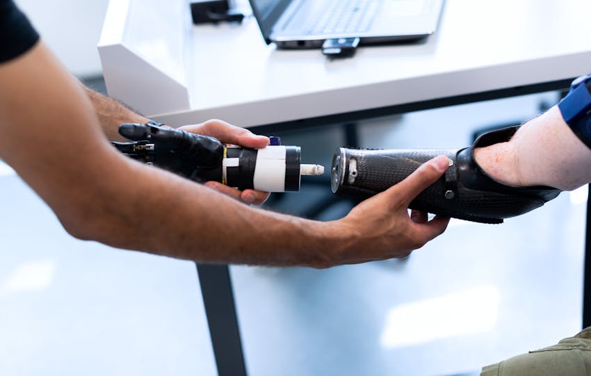 Person helping another attach a prosthetic arm, showcasing technology and support.